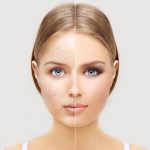 لتفادي حوادث الانزلاق بالشتاء اتبعي الارشادات التالية…