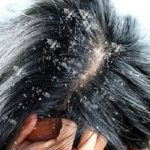 أسباب وأحدث علاجات جفاف العين