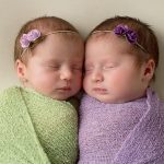 نصائح لمعالجة بشرتكِ من الحفر