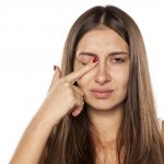 دراسة : قشرة الرأس قد ترتبط بمرض خطير ومزمن