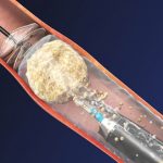 لصحة جيدة أيهما افضل استهلاك الزبدة أم السمن