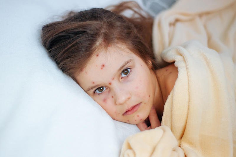 كيف أحدد مرض طفلي؟