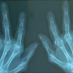 أفضل أنواع الأغذية، هل تتناولينها؟