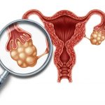 مقاومة الأنسولين عند الأطفال : الأعراض و العلاج